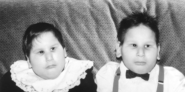What is the treatment for Cerebro Oculo Facio Skeletal Syndrome?